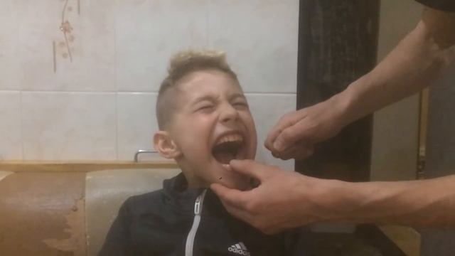 Как вырвать зуб