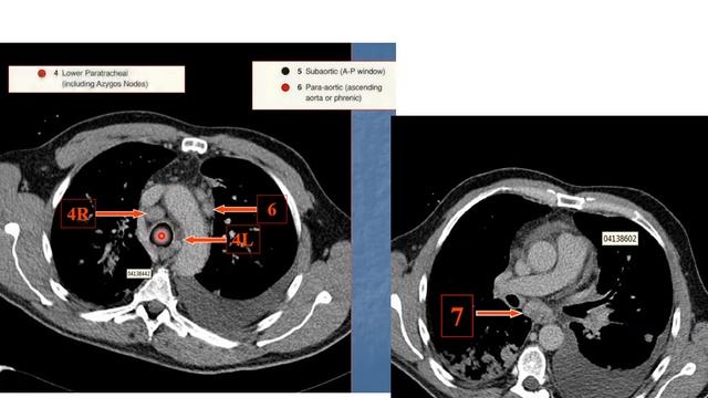 Echo endoscopie смотреть онлайн