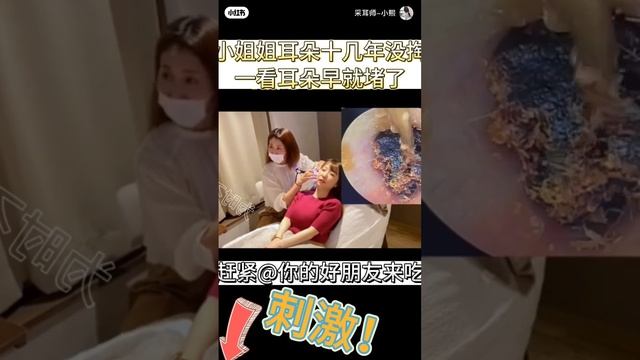 Наглядно что такое серная пробка и как ее убирают жесть, ушел чистить уши смотреть онлайн