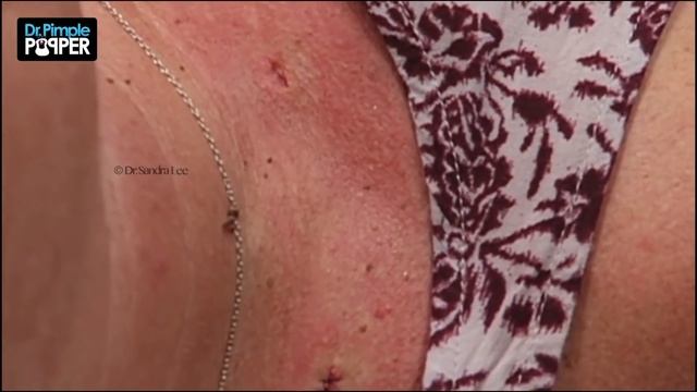 Dr. Pimple Popper's Weekly Story Time: Momma Squishy, Chapter 1 смотреть онлайн