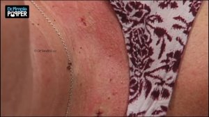 Dr. Pimple Popper's Weekly Story Time: Momma Squishy, Chapter 1