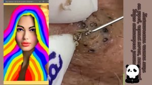 УДАЛЕНИЕ ЧЕРНЫХ ТОЧЕК И УГРЕЙ. АСМР. Релакс. Антистресс.