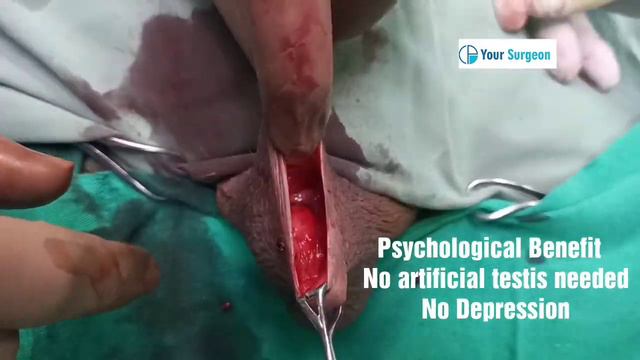 Testis Removal surgery in prostate cancer смотреть онлайн