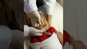 РЕБЕНОК СЪЕЛ МОНЕТУ