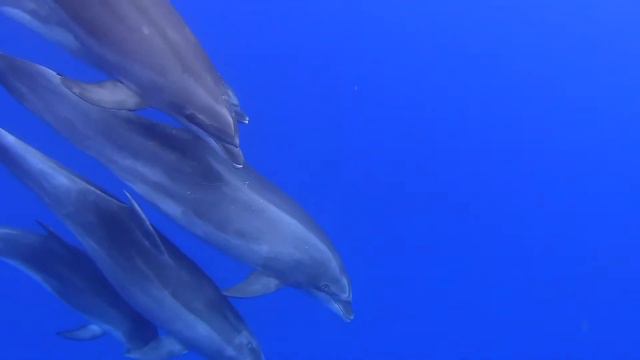 Dolphin singing | Soothing Music for Meditation, Therapy, Sleep смотреть онлайн
