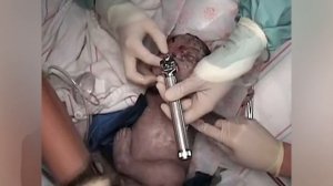 Семинар реанимация новорожденного