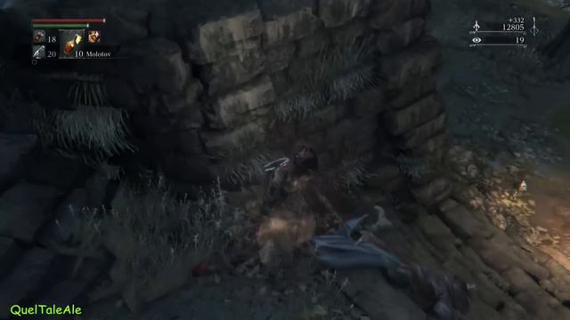 Bloodborne - Gameplay ITA - Walkthrough #18 - Hemwick Charnel Lane смотреть онлайн