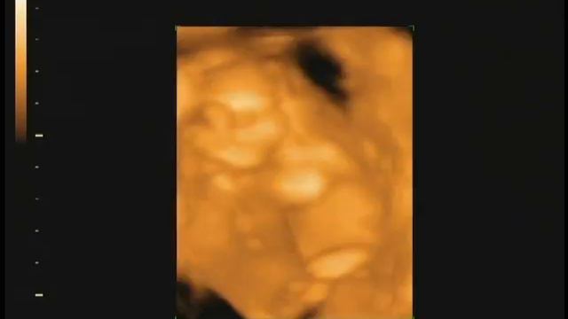 IT'S A BOY !!! JACOB KINGSTON MALAWI GEORGE смотреть онлайн