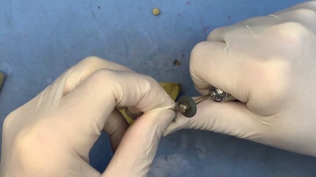 Repair broken clasp partial denture.Починка сломанного кламмера съемного протеза смотреть онлайн