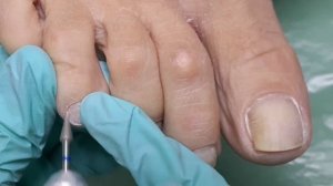 Мастер-класс ? ОБРАБОТКА ПАЛЬЧИКОВ В ПЕДИКЮРЕ