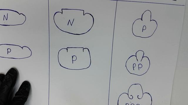 Вросший ноготь | Как удалить ноготь.Причины вросших ногтей. Фрагмент лекции Игоря Пелогиевского. смотреть онлайн