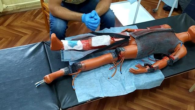 Ожоги смотреть онлайн