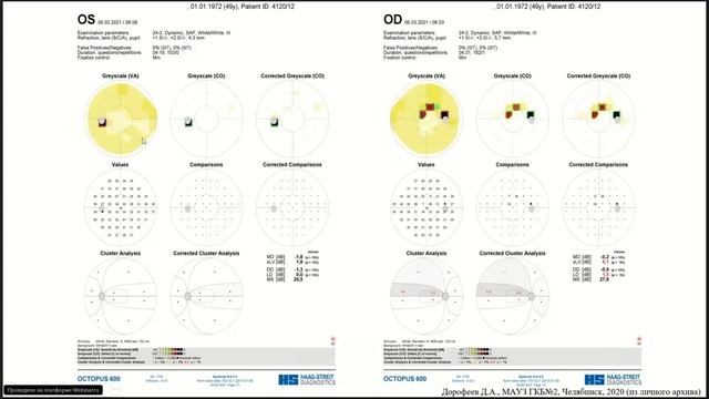 Особенности протоколов Octopus 900