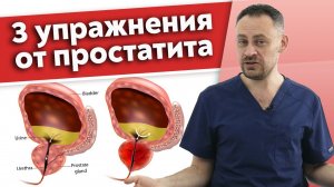 Плохо стоит? Виноват ПРОСТАТИТ!
3 эффективных практики. Профилактика и лечение простатита.