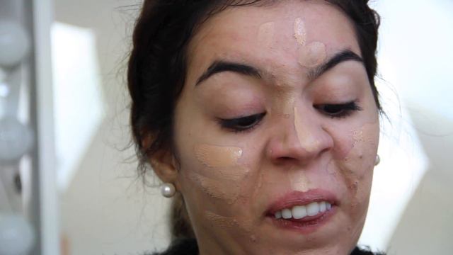 How I cover my ACNE | Lili Martins ♡ смотреть онлайн