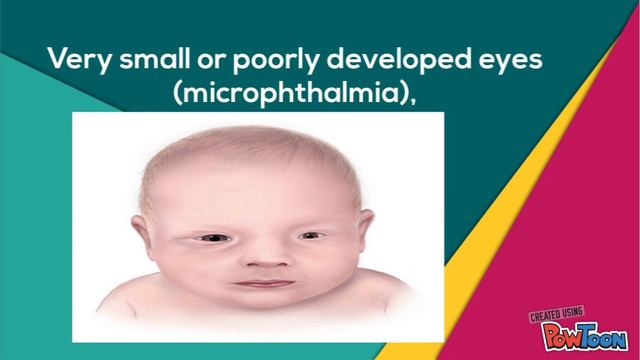 Trisomy 13 смотреть онлайн