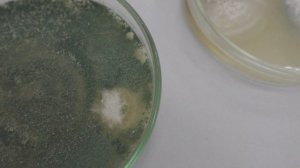 Фузариоз чеснока и лука: какие биопрепараты эффективны? Эксперимент с триходермой