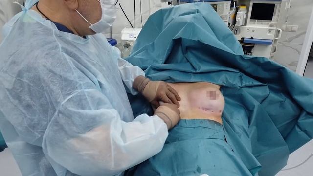 Александр Древецкий про липофилинг груди смотреть онлайн