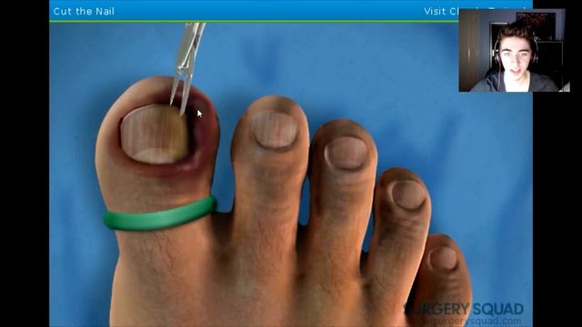 MOST DISGUSTING GAME EVER!? - Ingrown Toenail Surgery Simulator смотреть онлайн