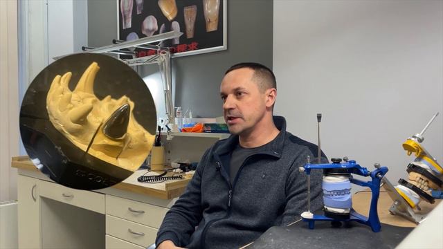 Интервью с зубным техником. Сколько зарабатывает? Чем отличается от стоматолога? Где обучаются? смотреть онлайн