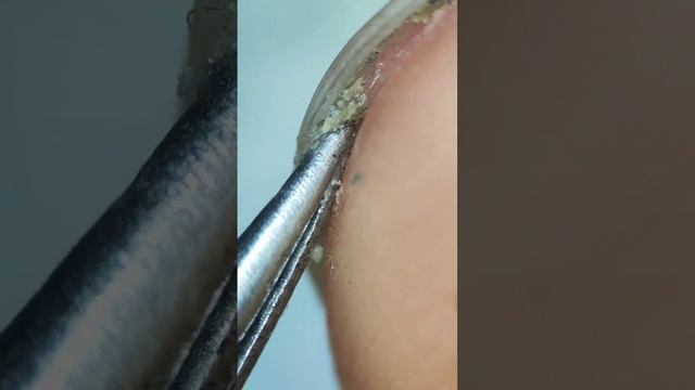 НОГТИ ПОД МИКРОСКОПОМ смотреть онлайн