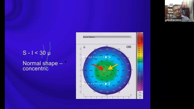 KOS PG sessions- Exam busters- module 1 смотреть онлайн