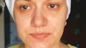 Видео обзор вакуумного очистителя пор и проба на себе.