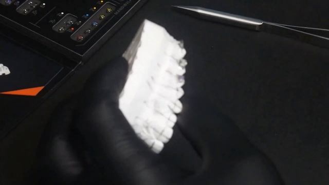 С. А. Попов: Непрямая фиксация брекетов Carriere SLX 3D на гипсовой модели. Изготовление каппы. смотреть онлайн