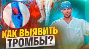 Тромбы в артериях и венах. Симптомы тромбообразования. У кого чаще возникают?