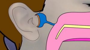 How to use the Otovent