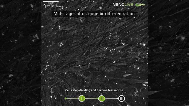 Остеогенез под микроскопом смотреть онлайн