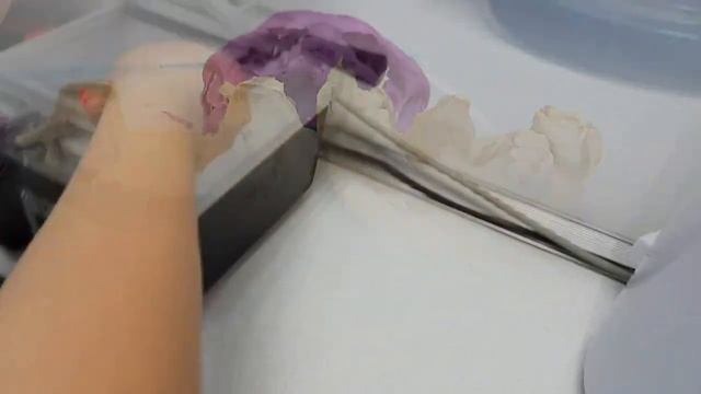 Стоматологические капы, капы от бруксизма (хруст и скрежет челюсти) смотреть онлайн