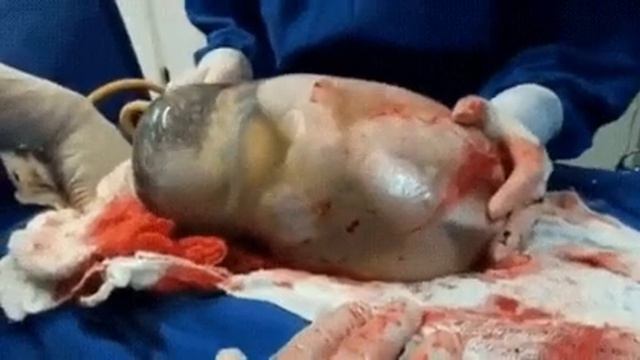 Родился в рубашке.. смотреть онлайн