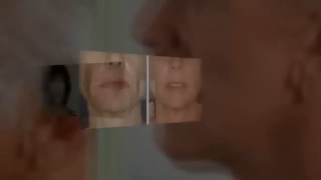 Мезонити лица: Фото ДО и ПОСЛЕ смотреть онлайн