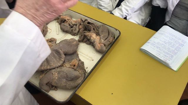 Шлунок / желудок ч.1 смотреть онлайн