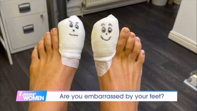 Frankie Bridge on Ingrown Toenails смотреть онлайн