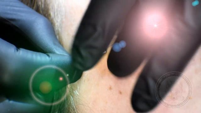 Anti-Brow Piercing
