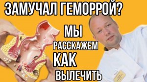 как лечить геморрой? #поликлиника #медицина #геморой