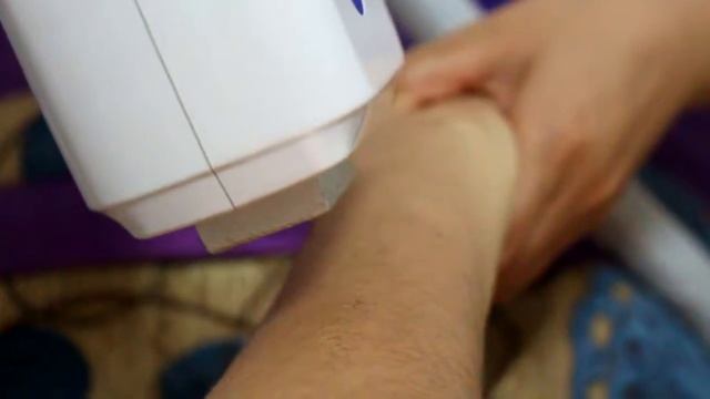 15X27mm 808nm Laser Hair Removal for Arm - VCA TECH смотреть онлайн