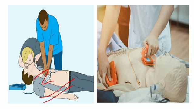 Difference between heart attack / fail / block & cardiac arrest ? смотреть онлайн