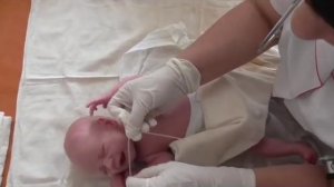 Постановка желудочного зонда новорожденным и грудным детям