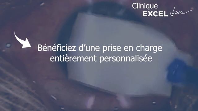 La clinique EXCEL Vision, une nouvelle vue commence ! смотреть онлайн