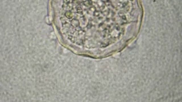 mikrogeo video 4 arcella pseudopods смотреть онлайн