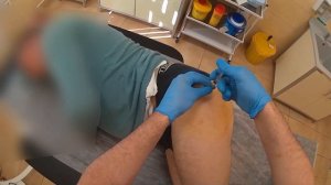 | Доктор Хисомов делится навыками | Инъекция большого вертела бедра (Трохантерит)