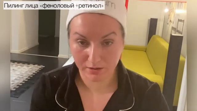 Феноловый пилинг . Жёлтый пилинг (ретиноловый ) Sesderma by mediderma смотреть онлайн