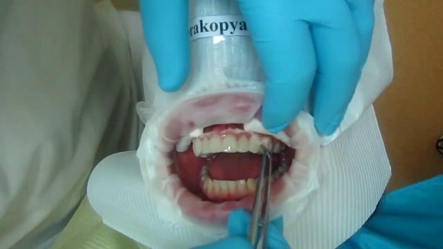 Люминиры установка. Часть 2 смотреть онлайн