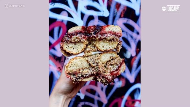 Aspiring Dancer Hit By Car Turns Tragedy Into New Passion Through Food Blogging | Bite Size