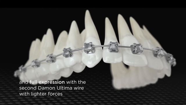 The Damon Ultima System – 'really exciting to see and experience' смотреть онлайн