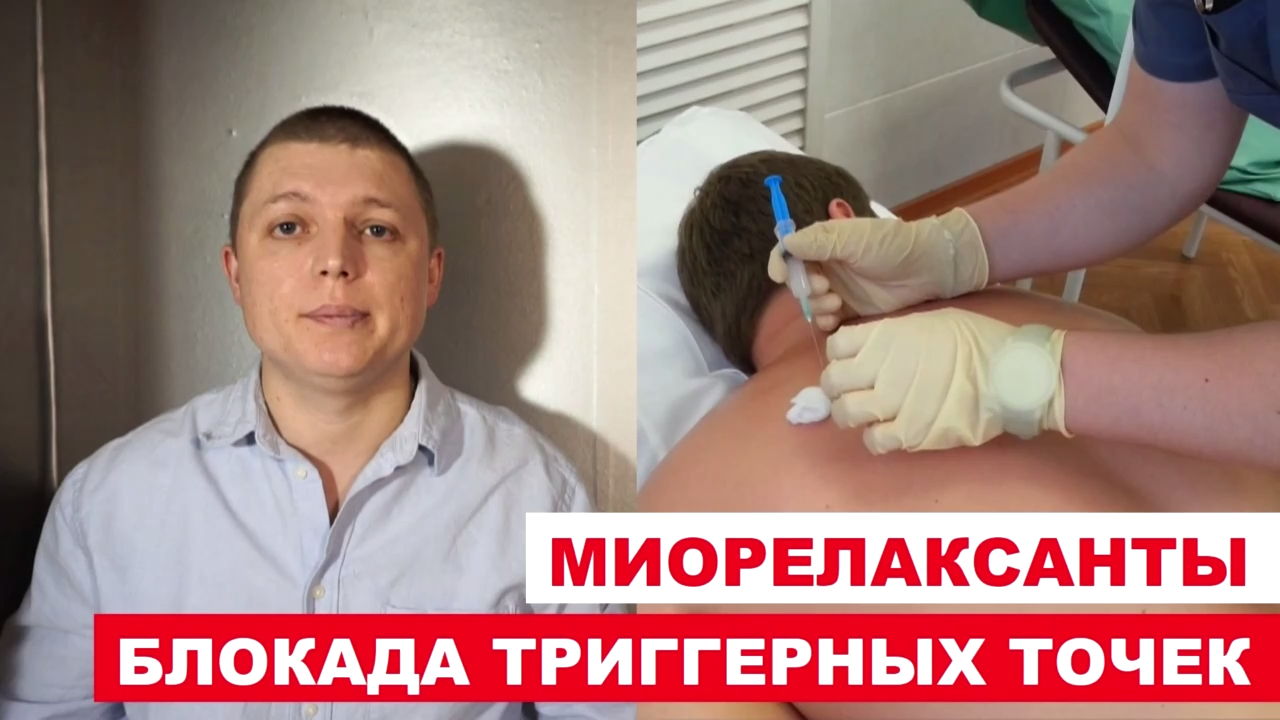 Миорелаксанты Блокада триггерных точек Trigger Point Injection смотреть онлайн