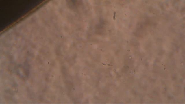 310 полынь плюс Seilwurm тест 2 дня смотреть онлайн